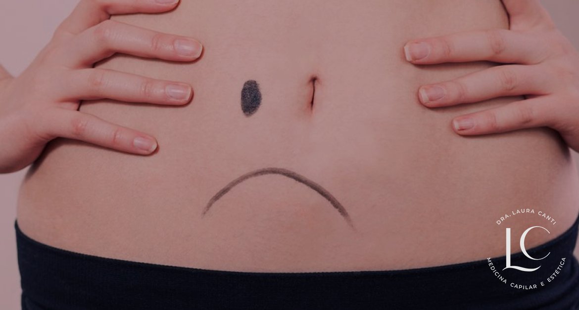 Umbigo triste: Tratamento sem cortes no corpo