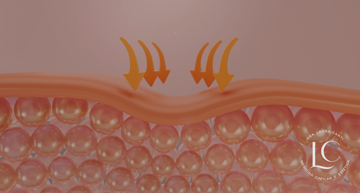 Bioestimuladores de Colágeno: Tudo o que você precisa saber
