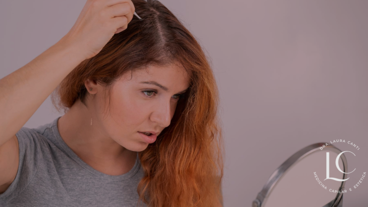 Quando a Queda de Cabelo em Mulheres se Torna Preocupante?